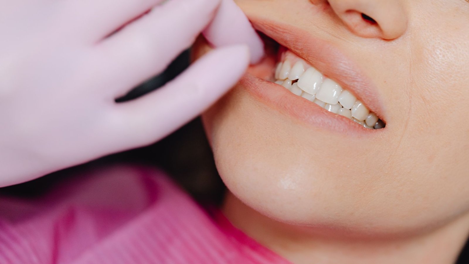 Tooth-colored composite fillings in Ladson, SC