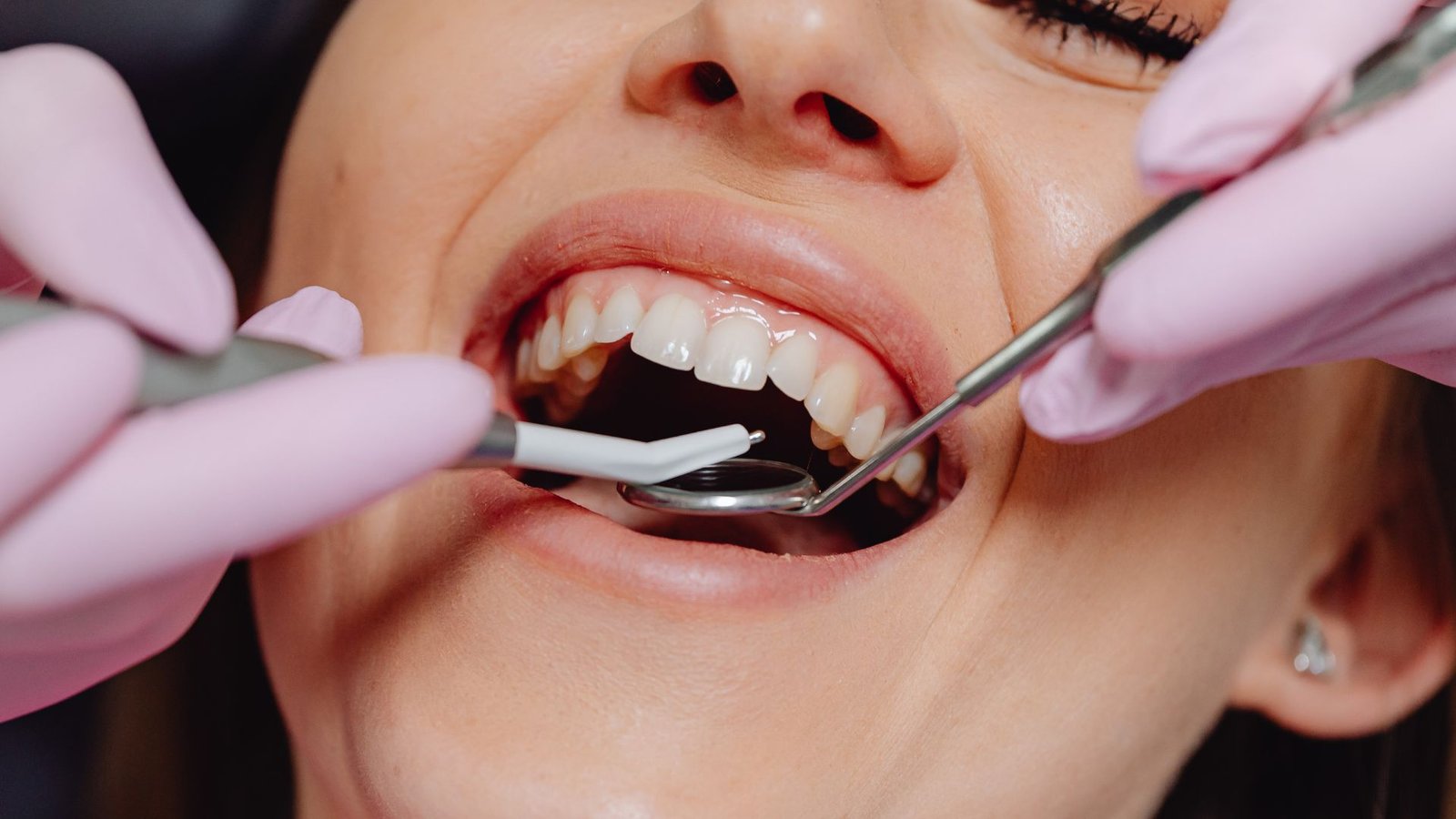 Dental bridges in Ladson, SC